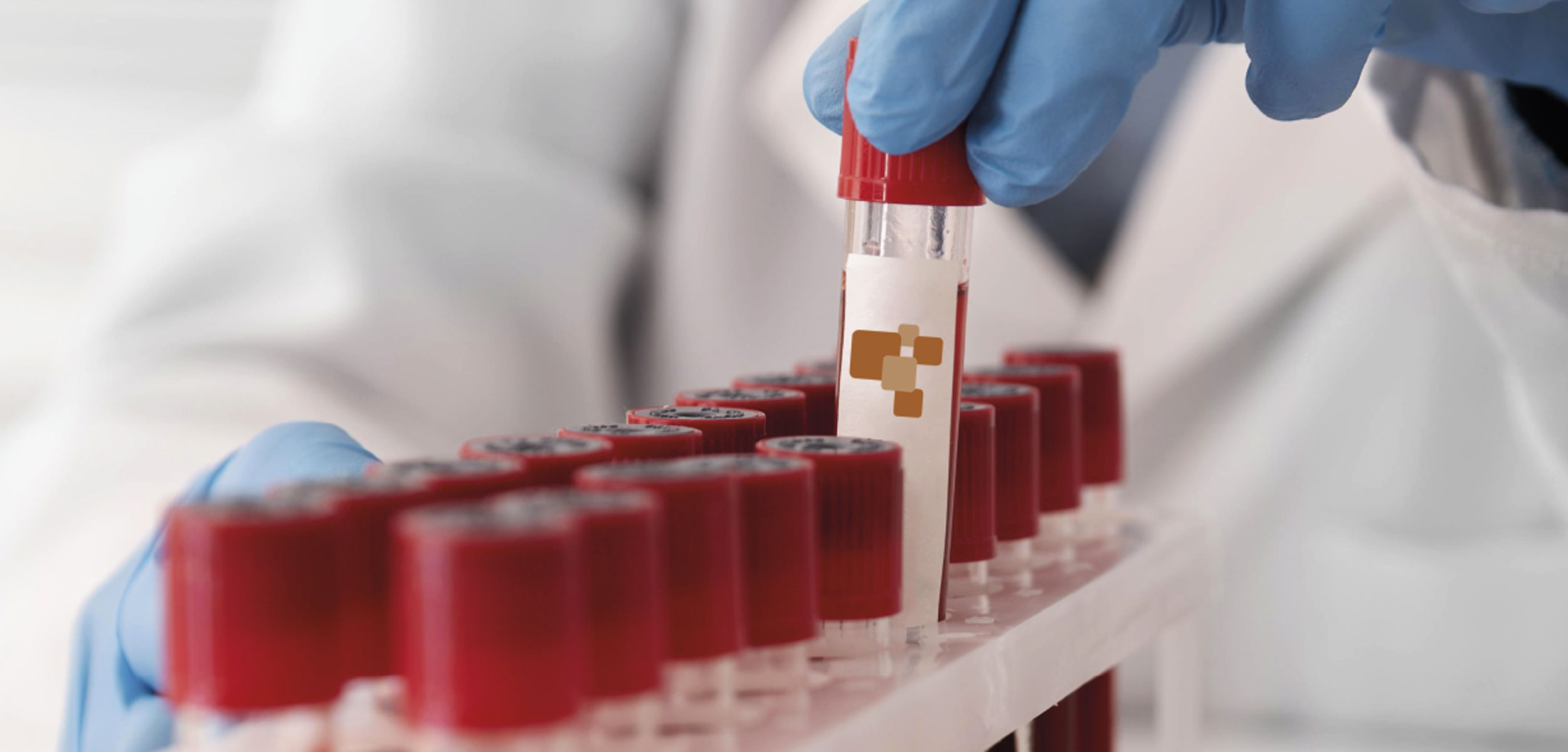 Toma de muestra exámenes laboratorio