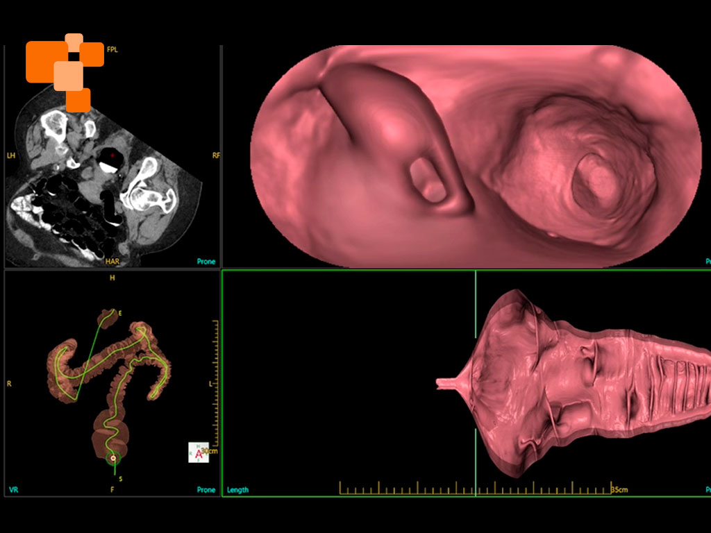 Equipo médico tomando un escáner en imagenología San Lorenzo